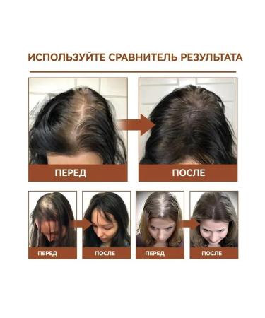 eelhoe Against hair loss power air conditioning repair is damaged - Buy Online on GoSupps.com