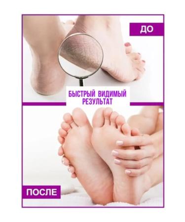 Nafisa-cosmetik Keratolytic gel for heels - Buy Online on GoSupps.com