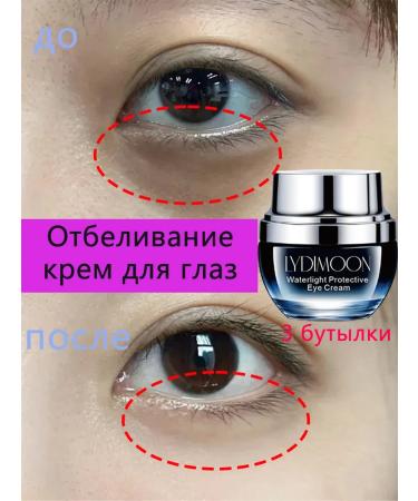 LYDIMOON Buy 2 get 1 free bleaching eye cream 30 g