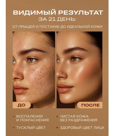 HELDI Anti-acne face serum - Buy Online on GoSupps.com