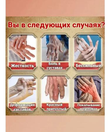 Gout cream 55 g against redness - Buy Online on GoSupps.com