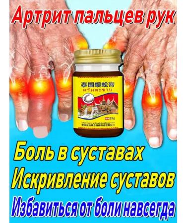 Anesthetic ointment with arthritis of the fingers and rheumatoid arthi