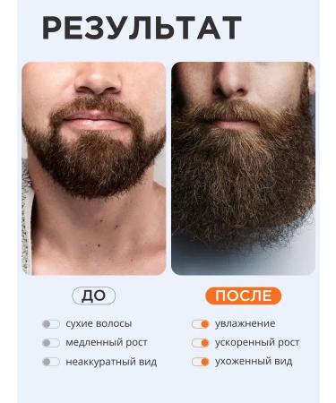 DRSKINVITA Oil for caring for laying a beard of mustache mitigating 30 ml - Buy Online on GoSupps.com