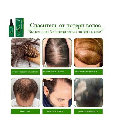 Disaar Hair growth from hair loss 120 ml - Buy Online on GoSupps.com