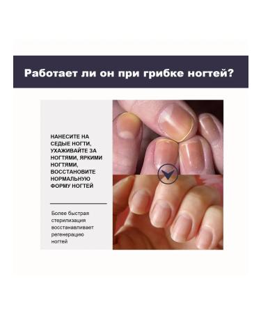 Serum to restore thickened nails with onykhomico ... - Buy Online on GoSupps.com
