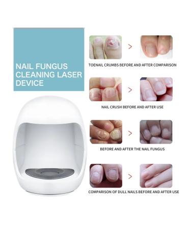 Device for thickened nails with onychomycosis - Buy Online on GoSupps.com