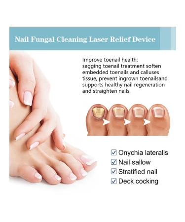 Device for thickened nails with onychomycosis - Buy Online on GoSupps.com