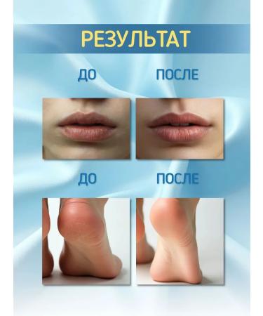 Vedik Essence Cosmetic petroleum jelly for face and body with coconut - Buy Online on GoSupps.com