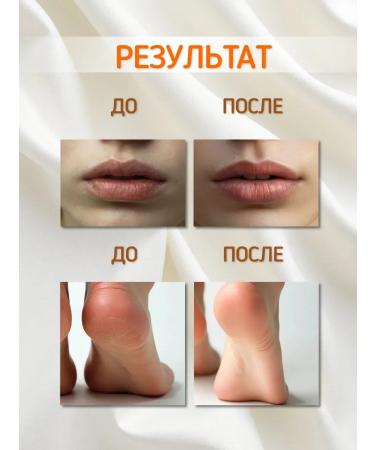 Vedik Essence Cosmetic Vaseline for Facial and Body - Buy Online on GoSupps.com