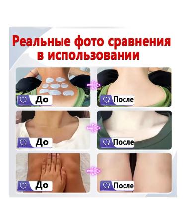 Skin restoration cream after tanning 140 g - Buy Online on GoSupps.com