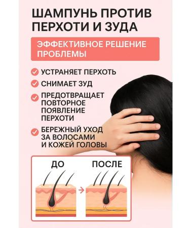 SOULWB Shampoo against dandruff and itching of the scalp 400 ml - Buy Online on GoSupps.com