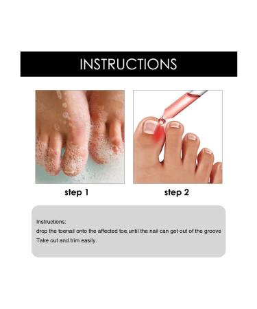 Restoring nails for nails 10ml - Buy Online on GoSupps.com