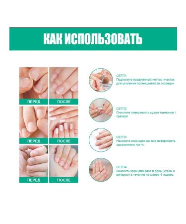 Kerassentials - Tratamiento nails from fungi - Buy Online on GoSupps.com