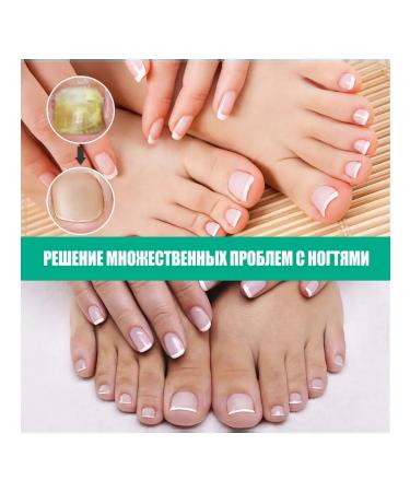 Kerassentials - Tratamiento nails from fungi - Buy Online on GoSupps.com