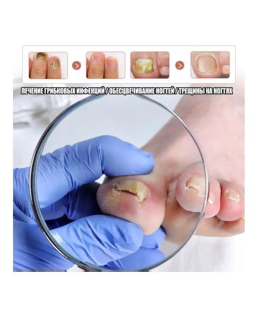 Kerassentials - Tratamiento nails from fungi - Buy Online on GoSupps.com