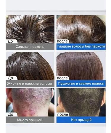 LYDIMOON Shampoo against falling out and for powerful hair growth female - Buy Online on GoSupps.com