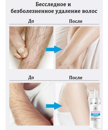 LYDIMOON Private hair removal without traces 100 g - Buy Online on GoSupps.com