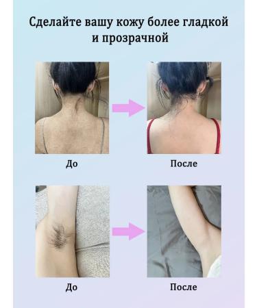 LYDIMOON Hair removal cream without traces 100 g 5 bottle - Buy Online on GoSupps.com