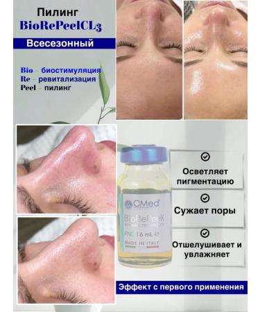 BioRePeelCl3 Professional Facial Piling Biorepil - Buy Online on GoSupps.com