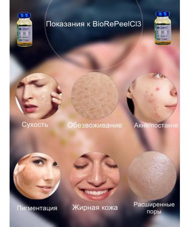 BioRePeelCl3 Professional Facial Piling Biorepil - Buy Online on GoSupps.com
