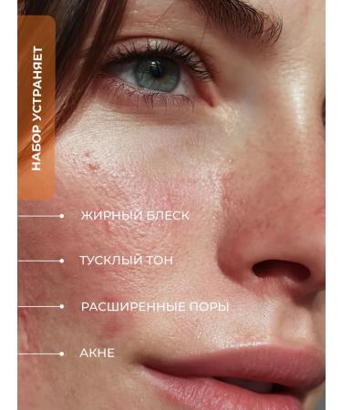 Belita Set for problem skin Stop acne tonic peeling cream - Buy Online on GoSupps.com