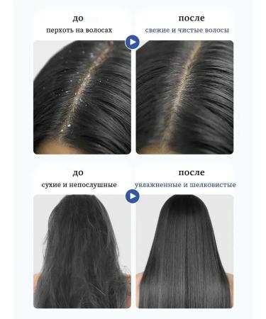 LYDIMOON Shampoo against dandruff with selenium disulfide 300 ml - Buy Online on GoSupps.com