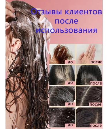LYDIMOON Shampoo against dandruff with selenium disulfide 300 ml*5 - Buy Online on GoSupps.com