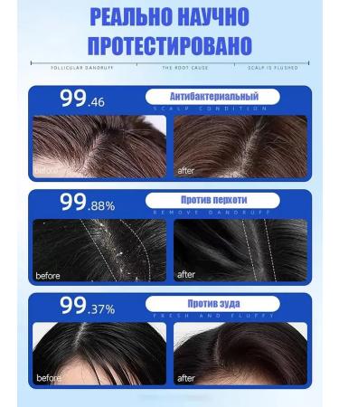 LYDIMOON Shampoo against dandruff with selenium disulfide 300 ml*5 - Buy Online on GoSupps.com