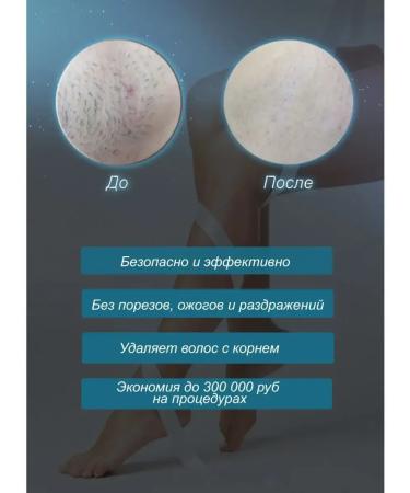 Facial and body laser photoepilator - Buy Online on GoSupps.com