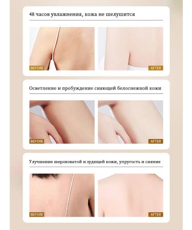 LYDIMOON Body milk whitening the softness of the skin + equal color - Buy Online on GoSupps.com