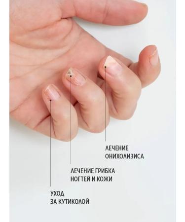 Smart Master Smart Paste from Onycholysis Nail - Buy Online on GoSupps.com