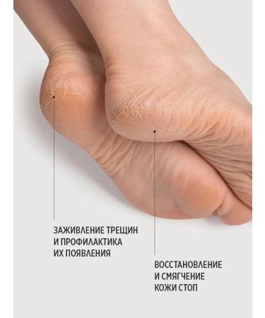 Smart Master Smart Paste from Onycholysis Nail - Buy Online on GoSupps.com