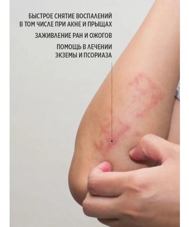 Smart Master Smart Paste from Onycholysis Nail - Buy Online on GoSupps.com