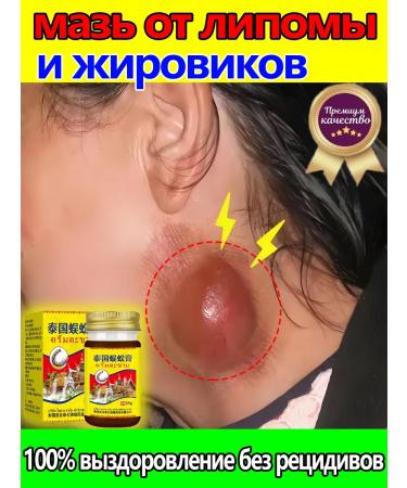 Ointment from Lipoma and Girovikov 55 g