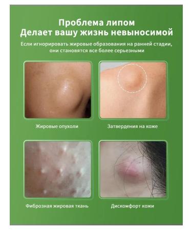 Ointment from Lipoma and Girovikov 55 g - Buy Online on GoSupps.com