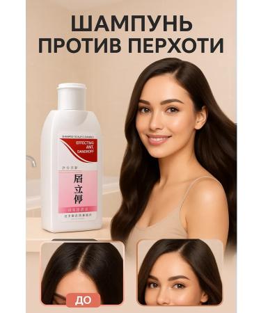 GKM1 effective shampoo against dandruff