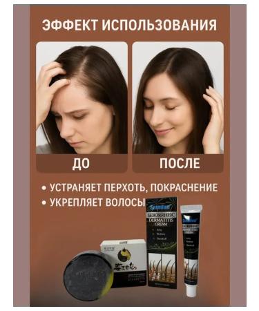 Everbloom Remedy for dandruff of hair loss soap-shampoo cream set - Buy Online on GoSupps.com