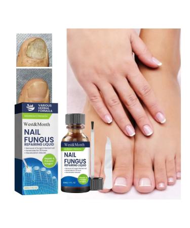 Nail fungus Treatment to moisturize fluid reduce itching pain pain - Buy Online on GoSupps.com