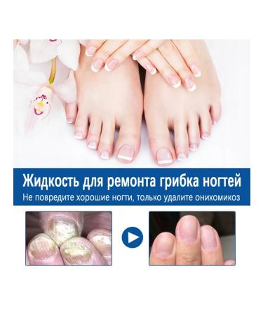 Nail fungus Treatment to moisturize fluid reduce itching pain pain - Buy Online on GoSupps.com