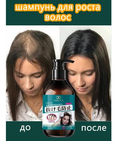 LYDIMOON Hair loss shampoo for growth 300ml