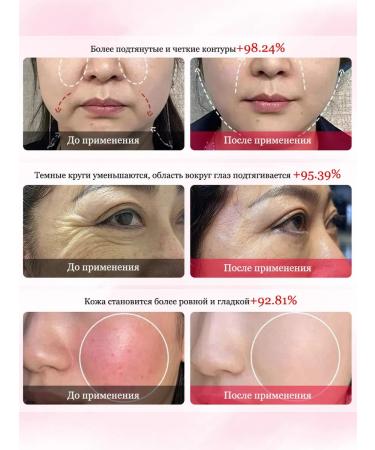 Ephlics Anti -aging anti -aging face cream against wrinkles - Buy Online on GoSupps.com