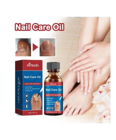 Treatment of fungal infections of care of nails with a solution of 10 mi - Buy Online on GoSupps.com