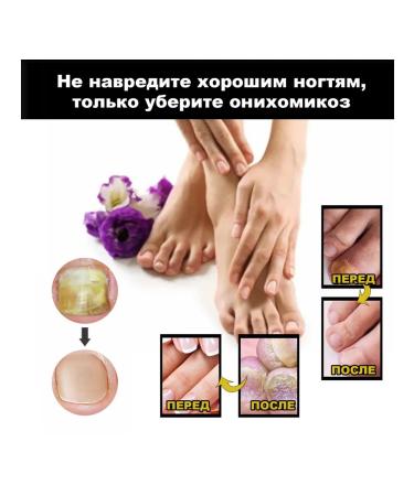 Eelhoe serum for treatment of nail fungus solution 30 ml - Buy Online on GoSupps.com