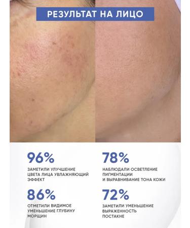 LYDIMOON Person serum anti -aging care 100 ml *3 - Buy Online on GoSupps.com