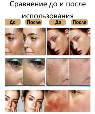 LYDIMOON Person's serum anti -aging care 100 ml *5 - Buy Online on GoSupps.com