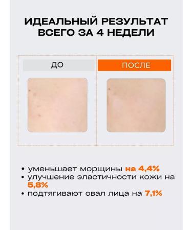 Great great Anti -aging face cream with microelaces - Buy Online on GoSupps.com