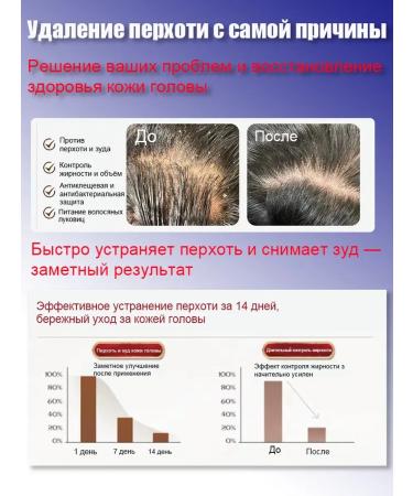 Hunmui Shampoo against dandruff with selenium disulfide - Buy Online on GoSupps.com