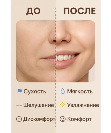 MIR88 Fruit hyaluronic moisturizing body lotion- scarlet - Buy Online on GoSupps.com