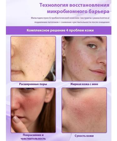 BEAUTITEM Hyra hydrogel caviar for face anti -aging Korea - Buy Online on GoSupps.com