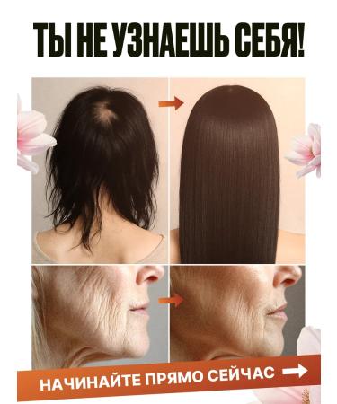 Sunshinelab Hair vitamins from falling out and growth